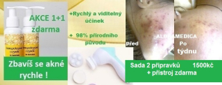 Akné kúra a podrážděná pleť a přístroj na čištění